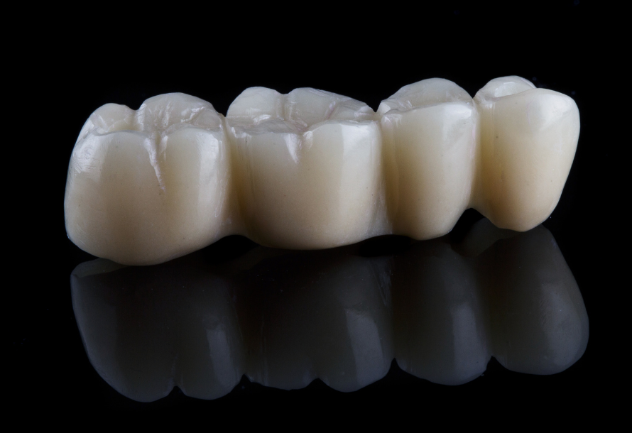 Dental Bridges at Dentistry 442 Rochdale